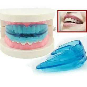 Detail Contoh Behel Palsu Nomer 37