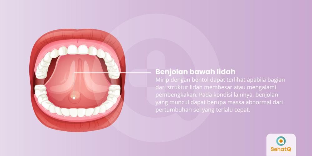 Detail Gambar Di Bawah Nomer 32