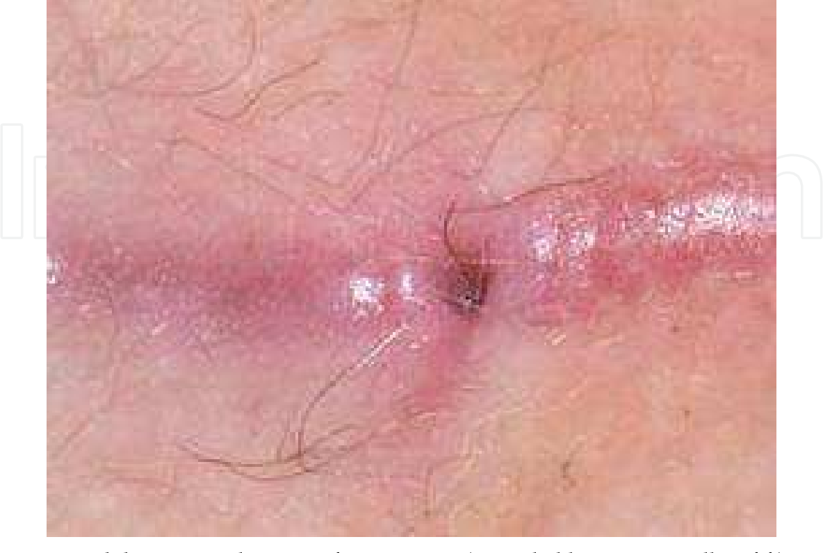 Detail Gambar Disease In Pns Nomer 4