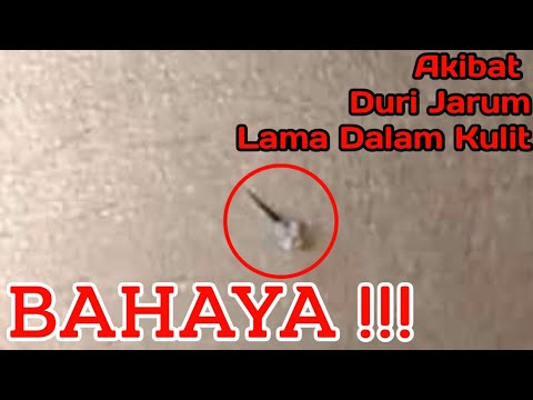 Detail Gambar Duri Salak Nomer 35