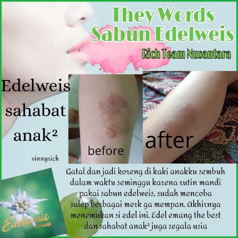 Detail Gambar Edelweis Sahabat Nomer 23