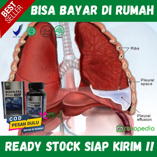 Detail Gambar Effusi Pleura Nomer 33