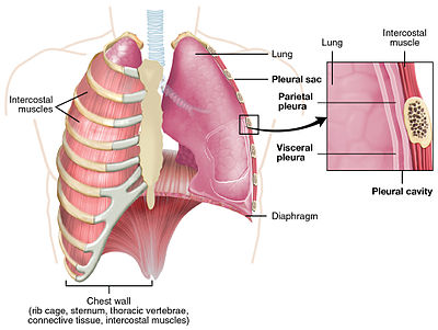 Detail Gambar Effusi Pleura Nomer 35