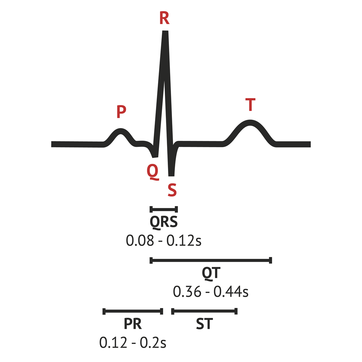 Detail Gambar Ekg Normal 12 Lead Nomer 36