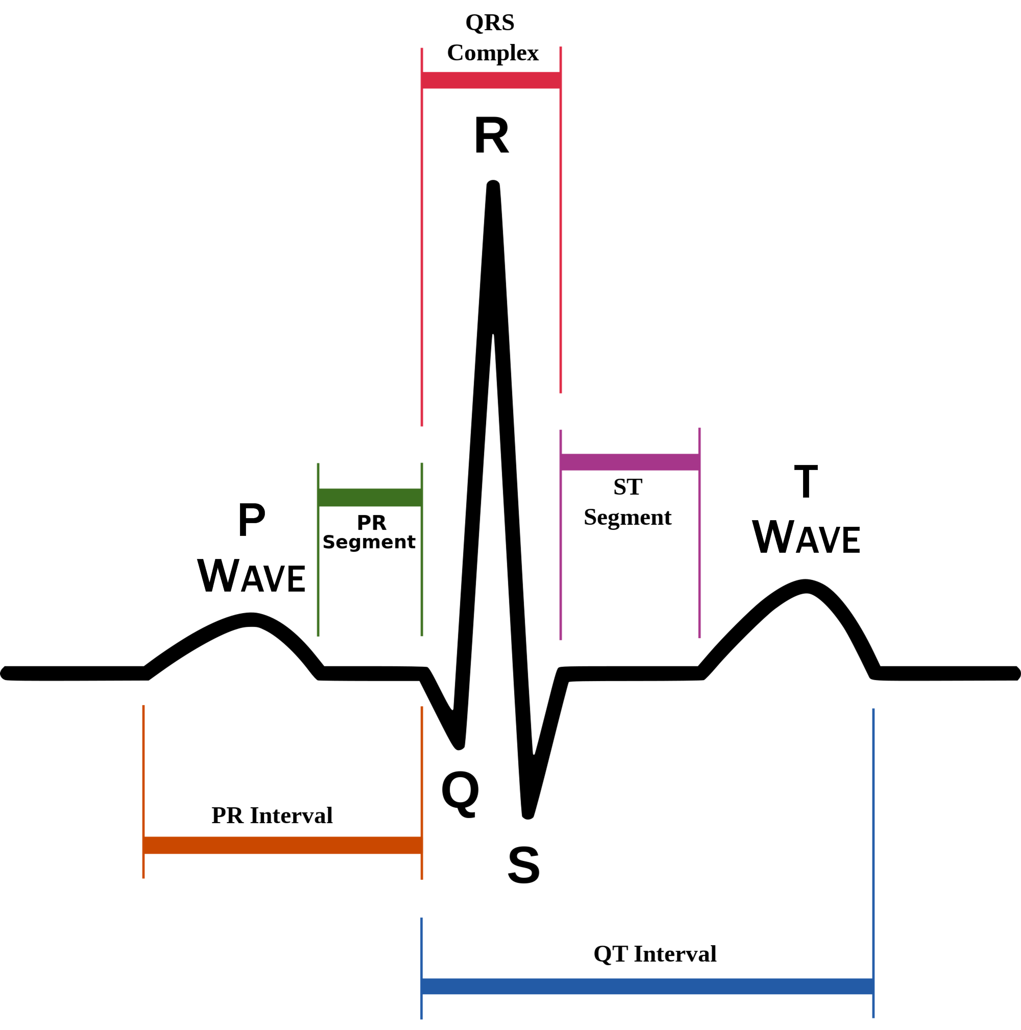 Detail Gambar Ekg Normal Nomer 20