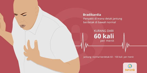 Detail Gambar Ekg Sinus Bradikardi Nomer 18