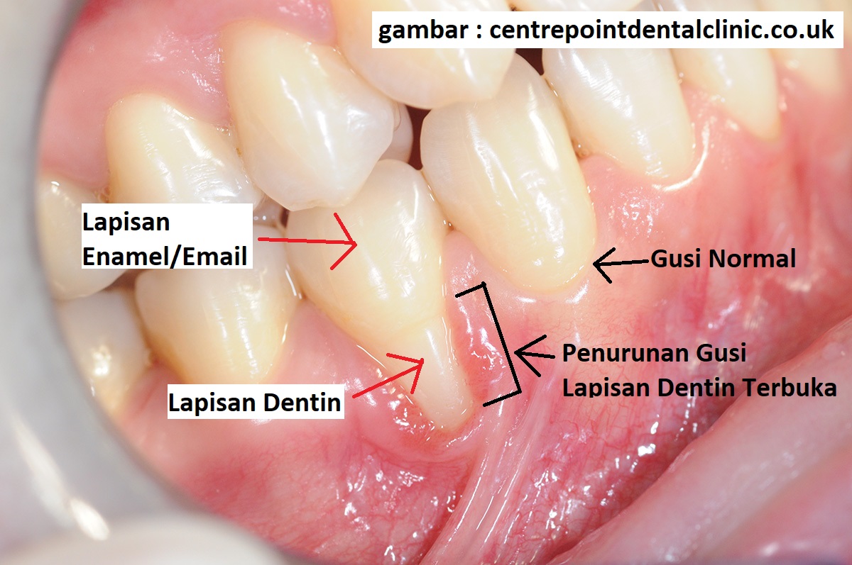 Detail Gambar Email Gigi Nomer 24