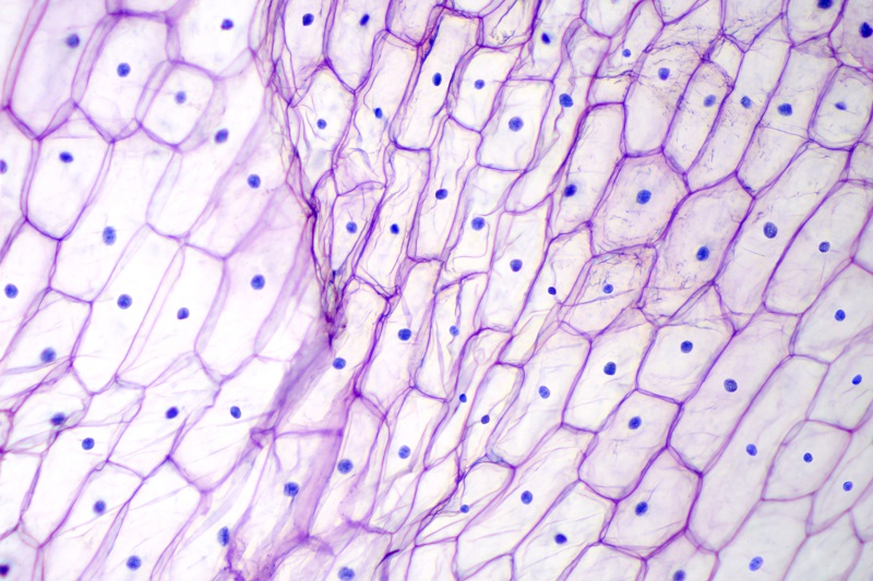 Detail Gambar Epidermis Tumbuhan Nomer 21