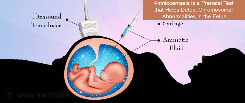 Detail Gambar Eritroblastosis Fetalis Nomer 7