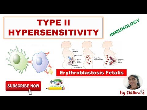 Detail Gambar Eritroblastosis Fetalis Nomer 23