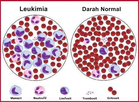 Detail Gambar Eritrosit Leukosit Dan Trombosit Nomer 28