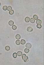 Detail Gambar Eritrosit Pada Urine Nomer 5