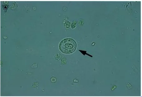Detail Gambar Eritrosit Pada Urine Nomer 9