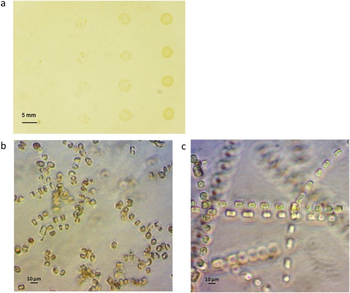 Detail Gambar Eritrosit Pada Urine Nomer 10