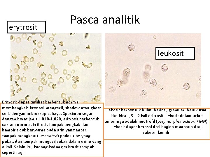 Detail Gambar Eritrosit Pada Urine Nomer 11