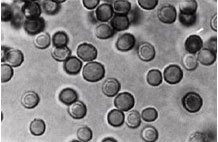 Detail Gambar Eritrosit Pada Urine Nomer 16