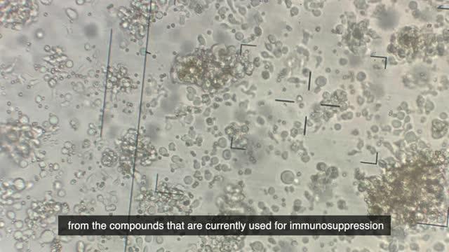 Detail Gambar Eritrosit Pada Urine Nomer 18