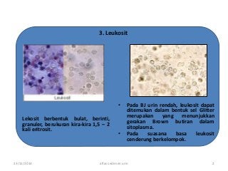 Detail Gambar Eritrosit Pada Urine Nomer 26