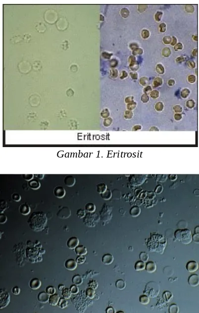 Detail Gambar Eritrosit Pada Urine Nomer 4
