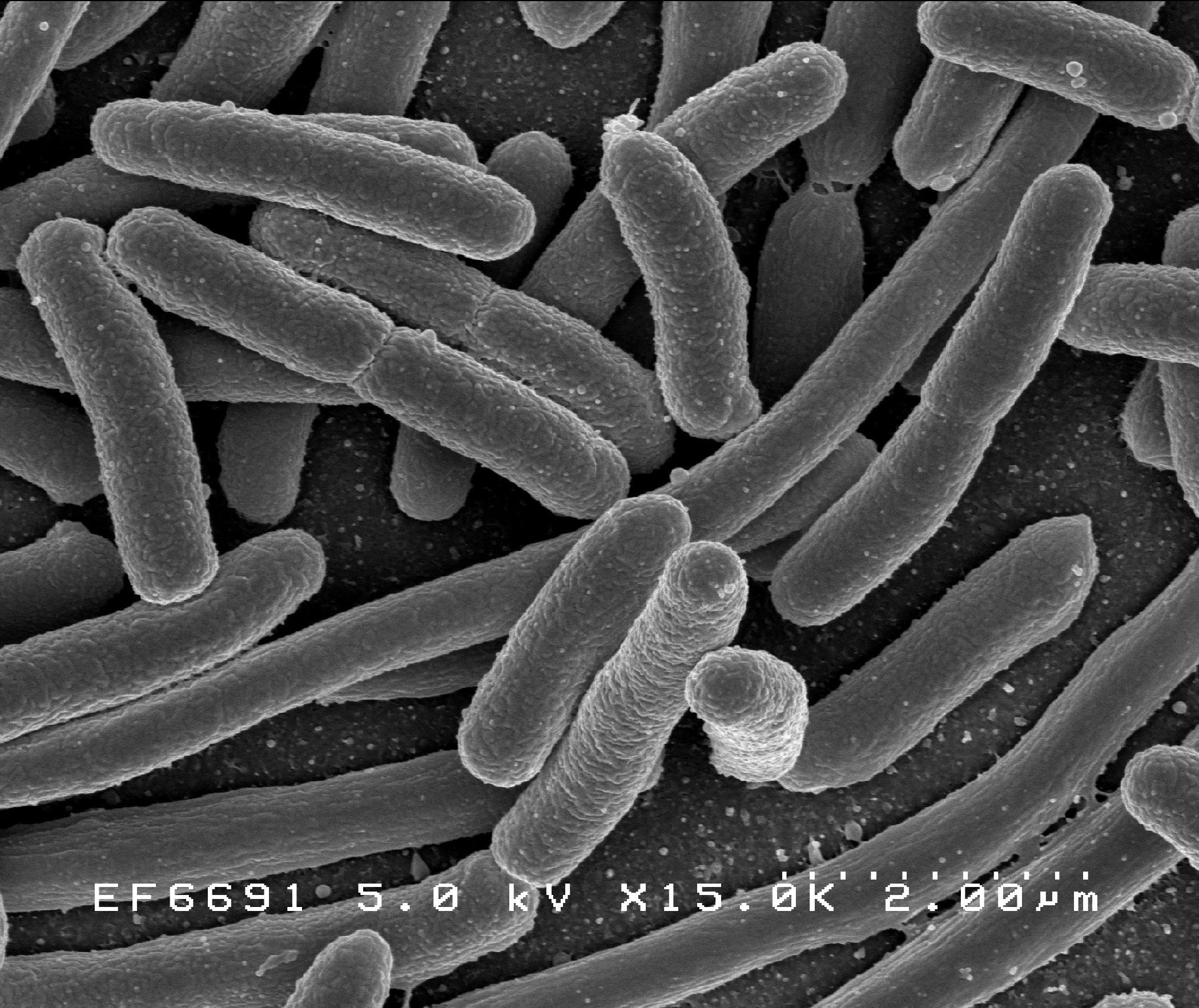 Gambar Escherichia Coli - KibrisPDR