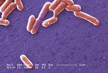 Detail Gambar Escherichia Coli Nomer 22