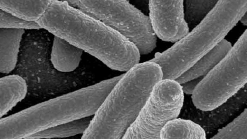 Detail Gambar Escherichia Coli Nomer 25