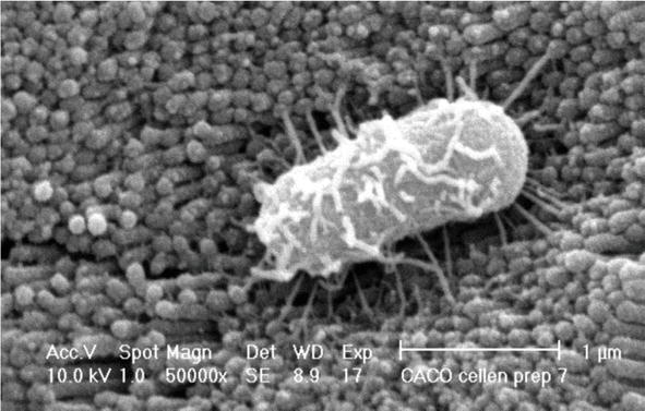 Detail Gambar Escherichia Coli Nomer 39