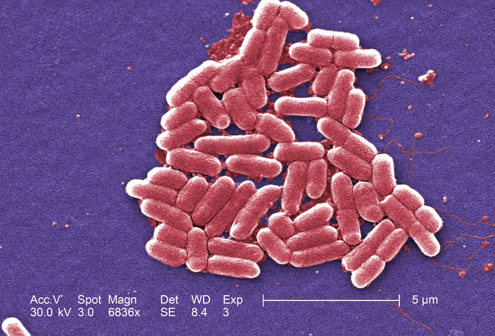 Detail Gambar Escherichia Coli Nomer 6