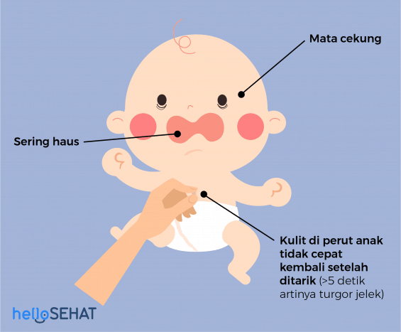 Detail Gambar Feses Bayi Diare Nomer 9