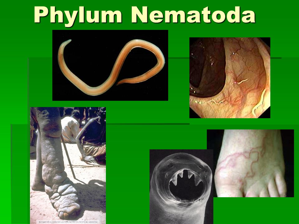 Detail Gambar Filum Nematoda Nomer 16