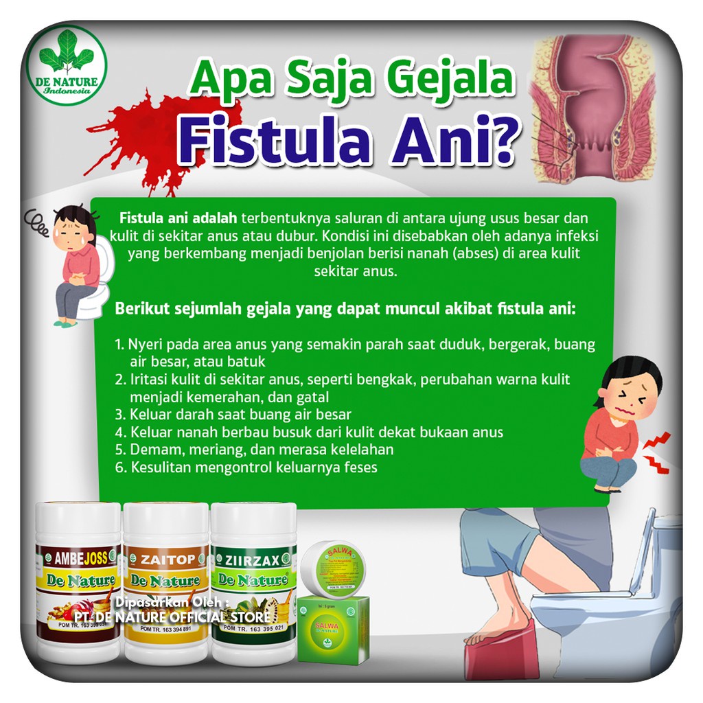 Detail Gambar Fistula Ani Nomer 10