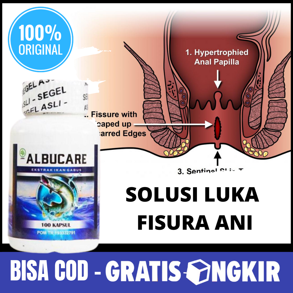 Download Gambar Fisura Ani Nomer 3