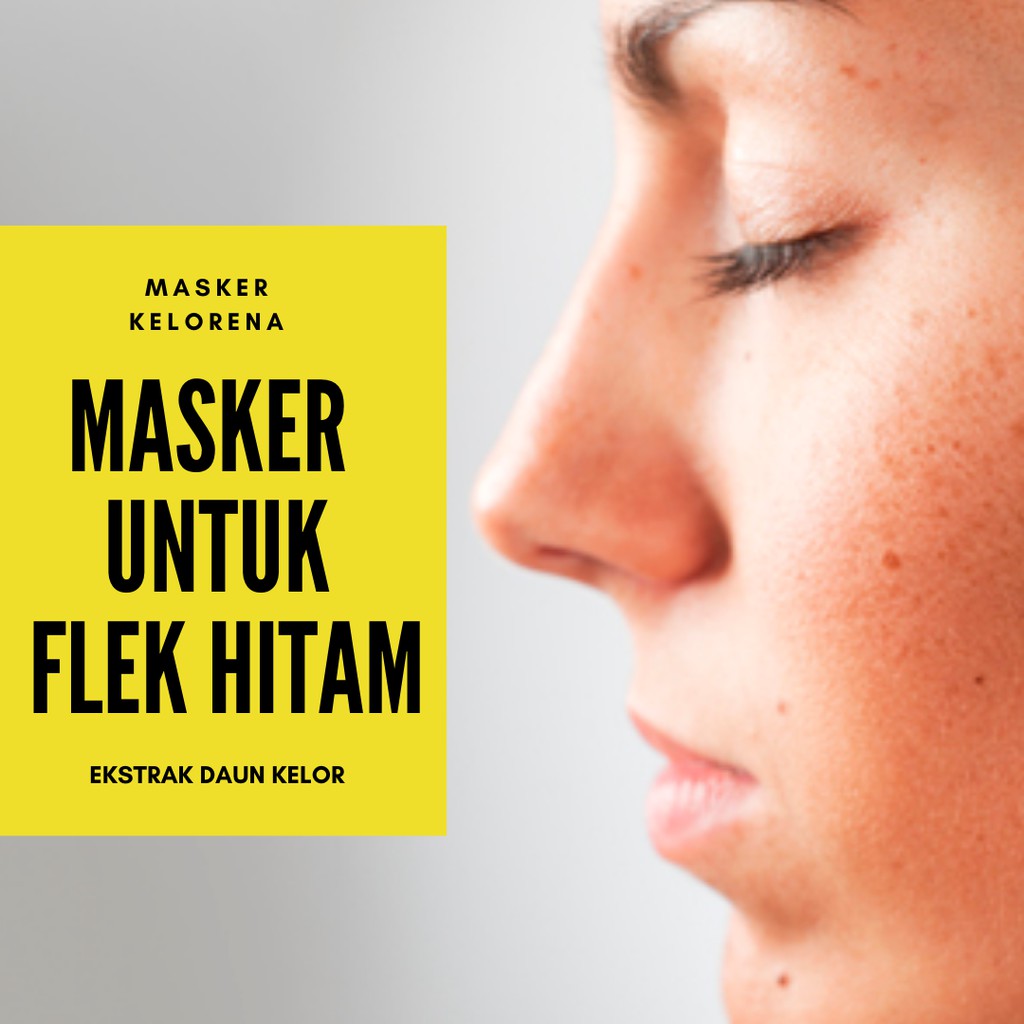 Detail Gambar Flek Hitam Di Hidung Nomer 15