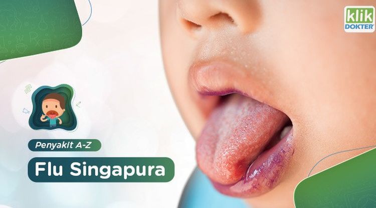 Detail Gambar Flu Singapura Pada Anak Nomer 40