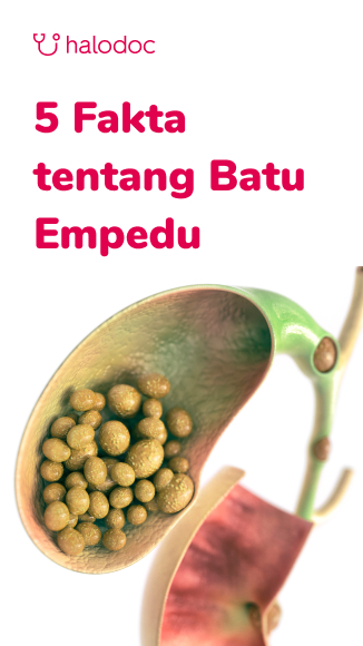 Detail Gambar Gambar Batu Empedu Nomer 4