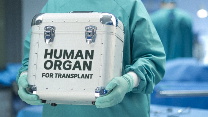 Detail Gambar Gambar Transplantasi Organ Nomer 39