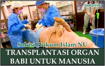 Detail Gambar Gambar Transplantasi Organ Gambar Gambar Transplantasi Organ Tubuh Nomer 26