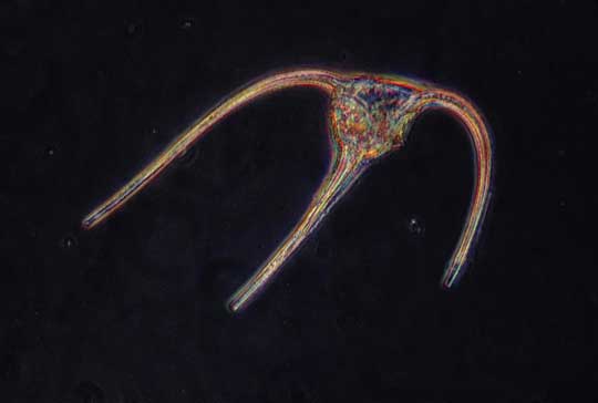 Detail Gambar Ganggang Coklat Fitoplankton Chrysophyceae Nomer 17