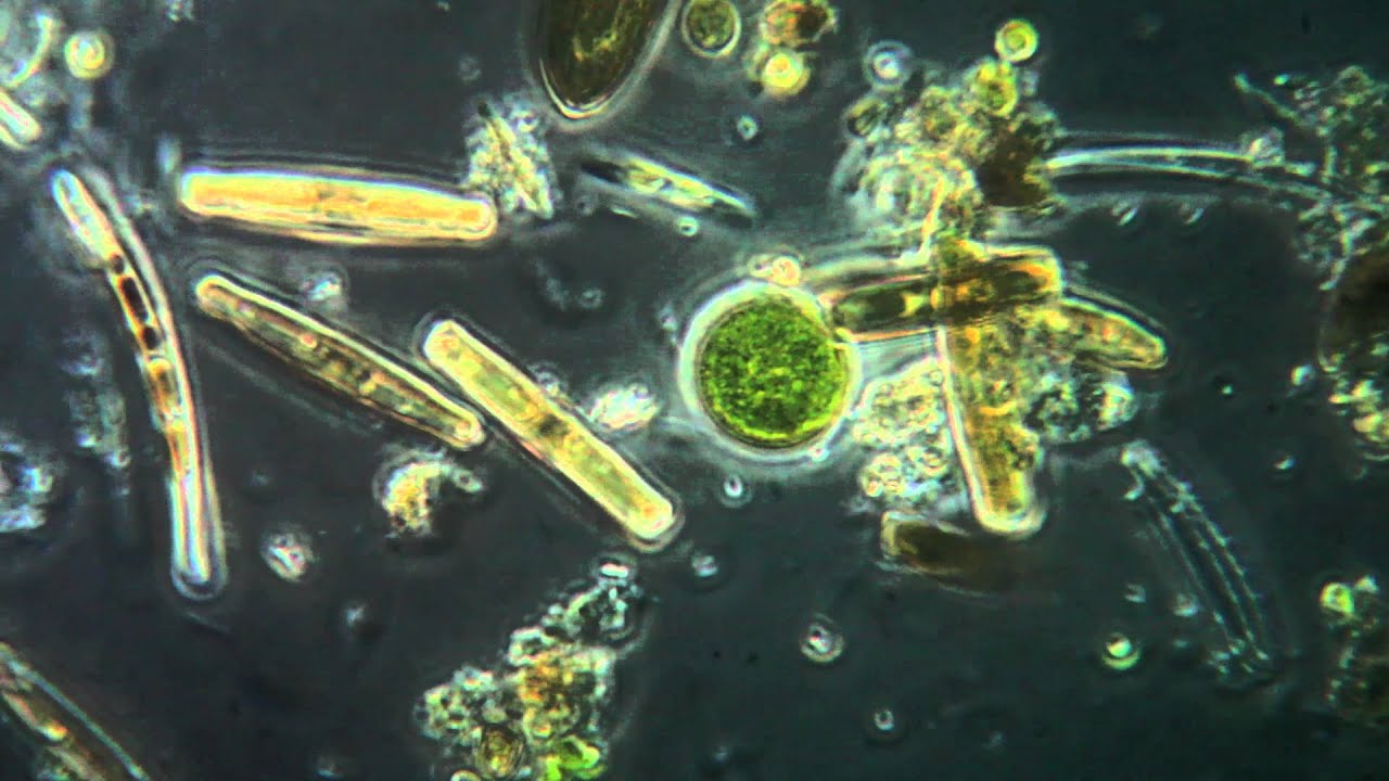 Detail Gambar Ganggang Coklat Fitoplankton Chrysophyceae Nomer 38