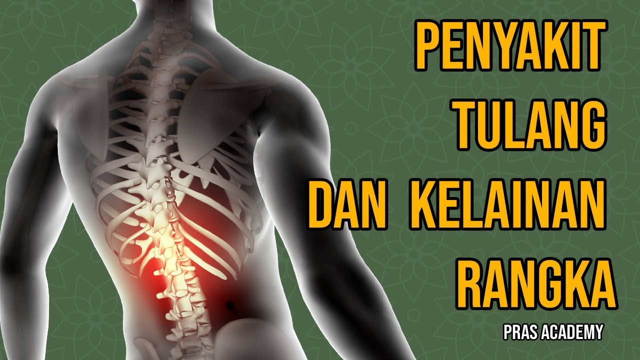 Detail Gambar Gangguan Dan Kelainan Pada Tulang Nomer 37