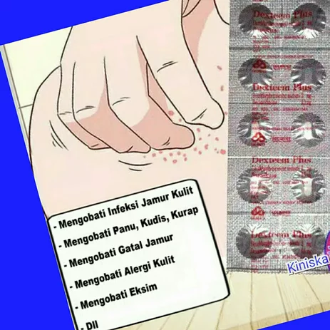 Detail Gambar Gatal Pada Kulit Nomer 24
