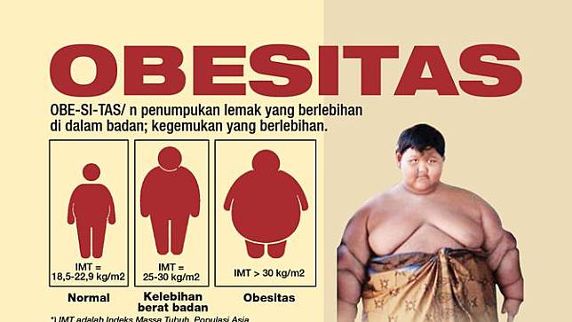 Detail Gambar Gejala Obesitas Nomer 2