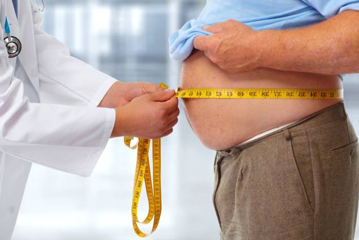 Detail Gambar Gejala Obesitas Nomer 31
