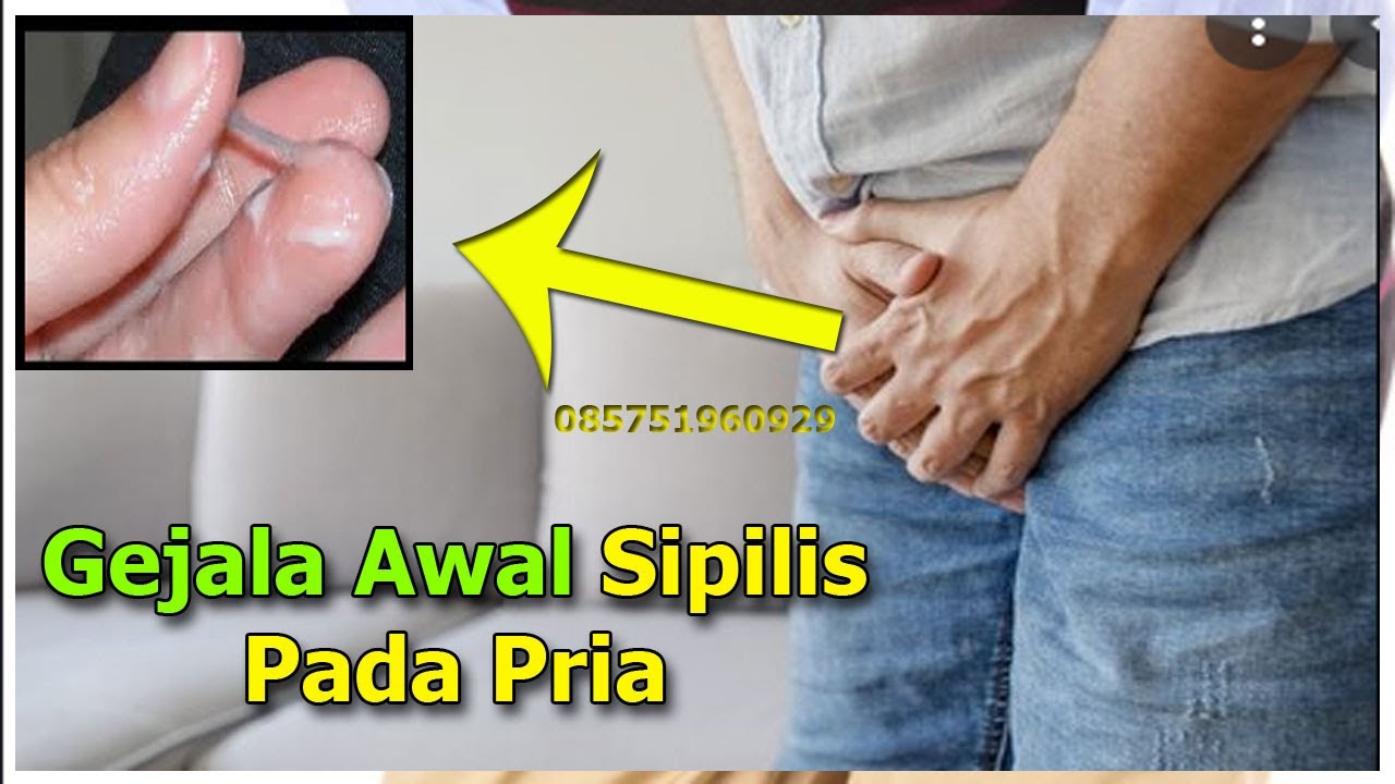 Detail Gambar Gejala Sipilis Pada Wanita Nomer 30