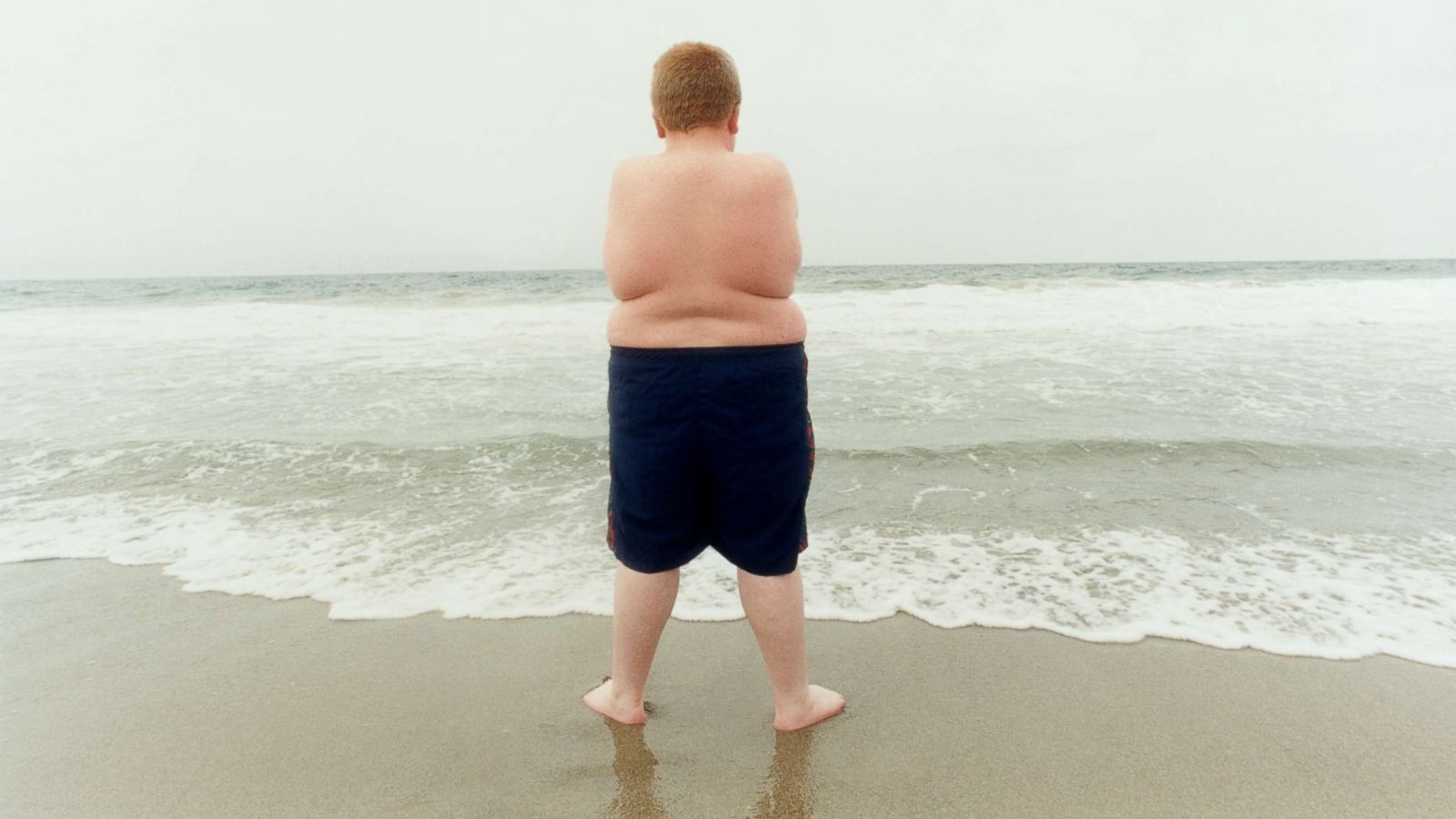 Detail Gambar Gemuk Dan Obesitas Nomer 27