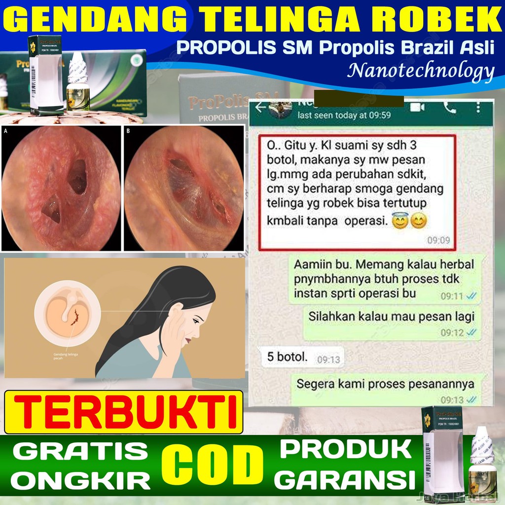 Detail Gambar Gendang Telinga Nomer 47