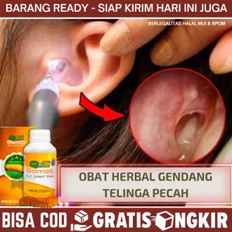 Detail Gambar Gendang Telinga Pecah Nomer 20