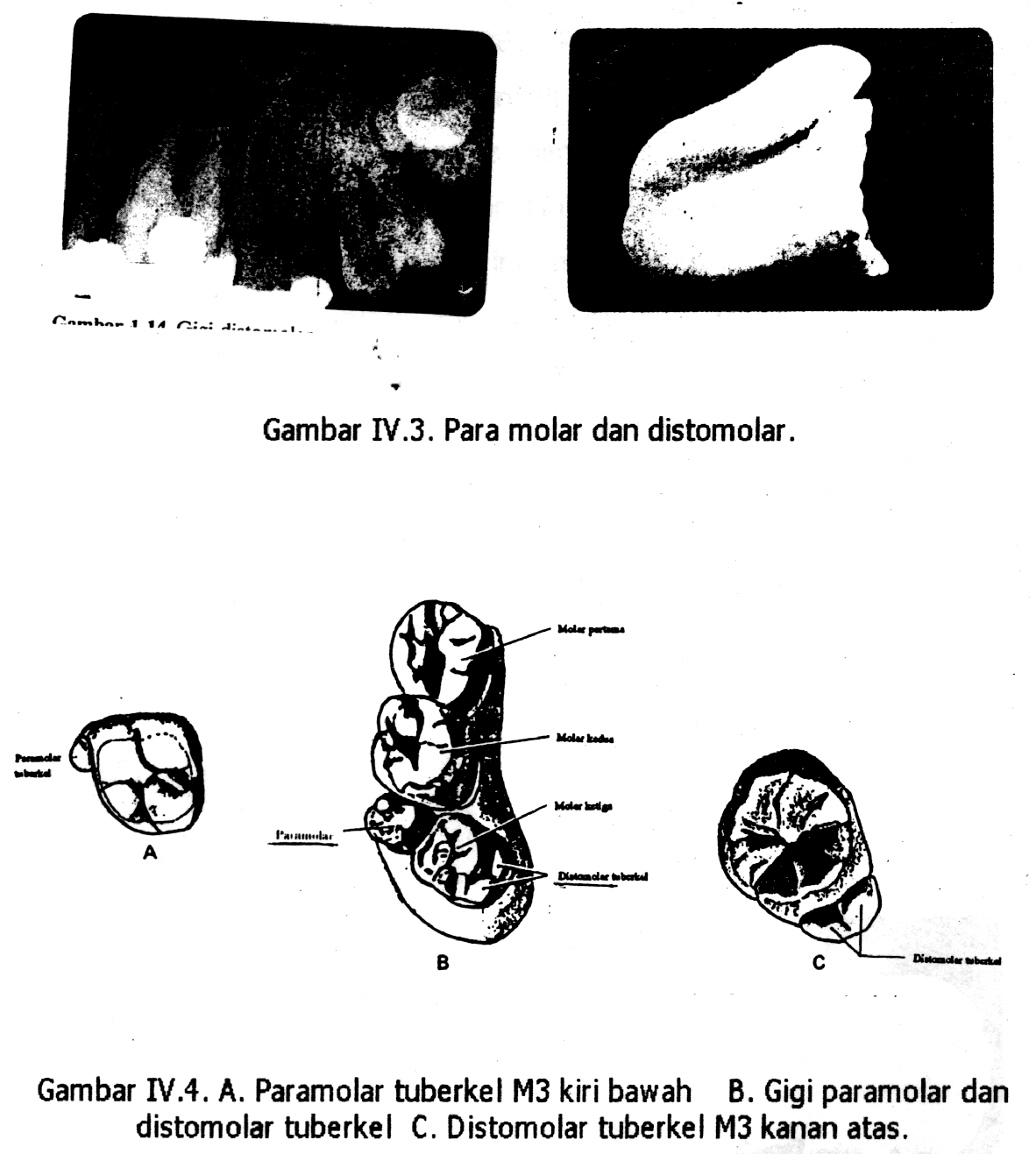 Detail Gambar Gigi Geligi Nomer 31