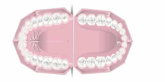 Detail Gambar Gigi Geligi Nomer 5