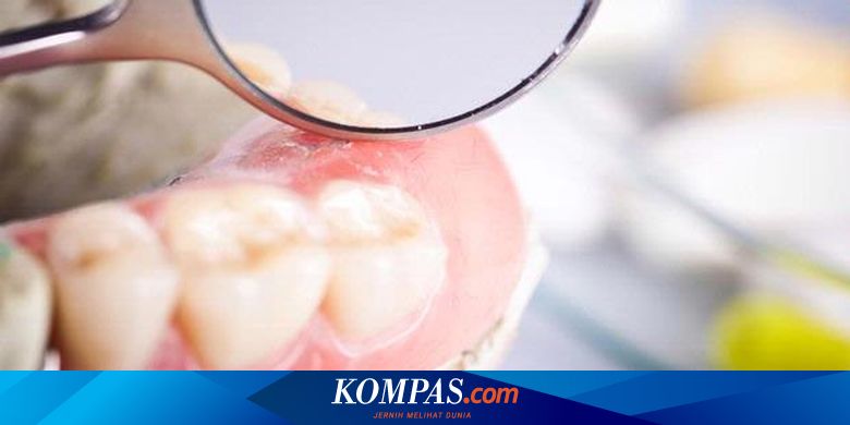 Detail Gambar Gigi Geraham Atas Nomer 49